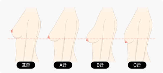 가슴거상 자가진단